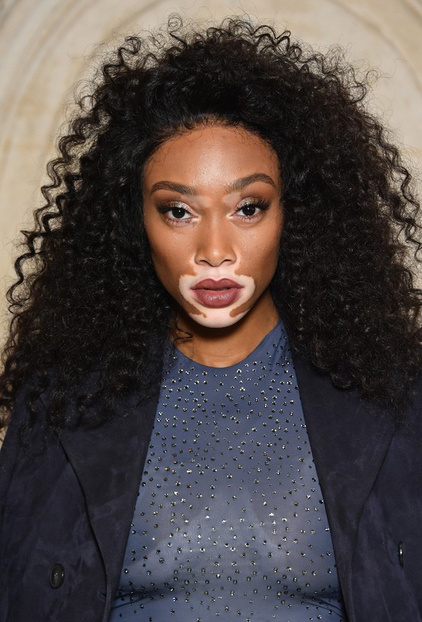 PARIS, FRANCE - SEPTEMBER 26: Winnie Harlow attends the Christian Dior show as part of the Paris Fashion Week Womenswear Spring/Summer 2018 on September 26, 2017 in Paris, France. (Photo by Pascal Le Segretain/Getty Images for Dior) (Foto: Getty Images for Dior)
